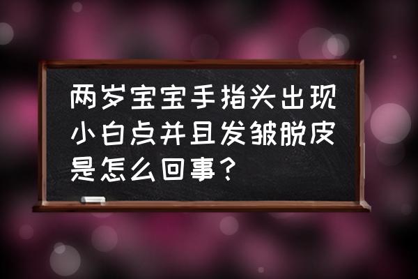 皮肤干燥引起的白斑能恢复吗 两岁宝宝手指头出现小白点并且发皱脱皮是怎么回事？