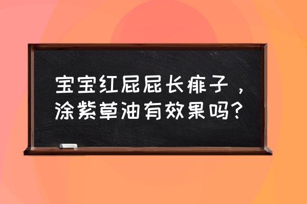 婴儿自制紫草油的正确用法 宝宝红屁屁长痱子，涂紫草油有效果吗？